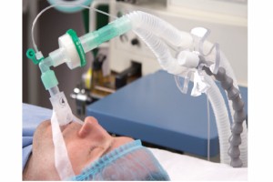 Ventilação Mecânica