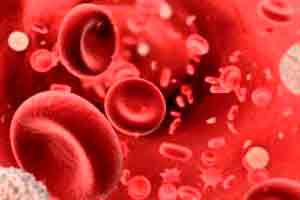 Anemias 