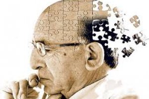 Doença de Alzheimer